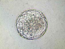 拡張期胚盤胞
